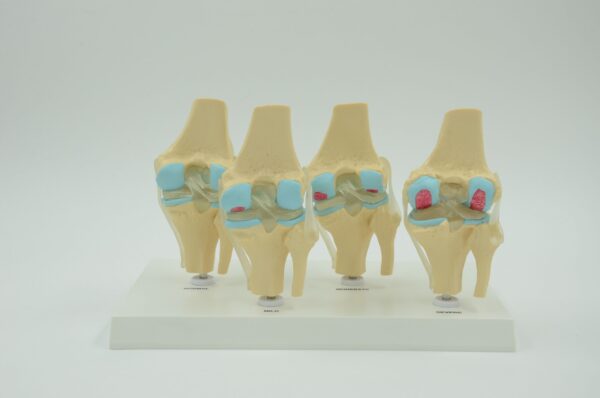 4-STAGE VERTEBRAE MODEL
