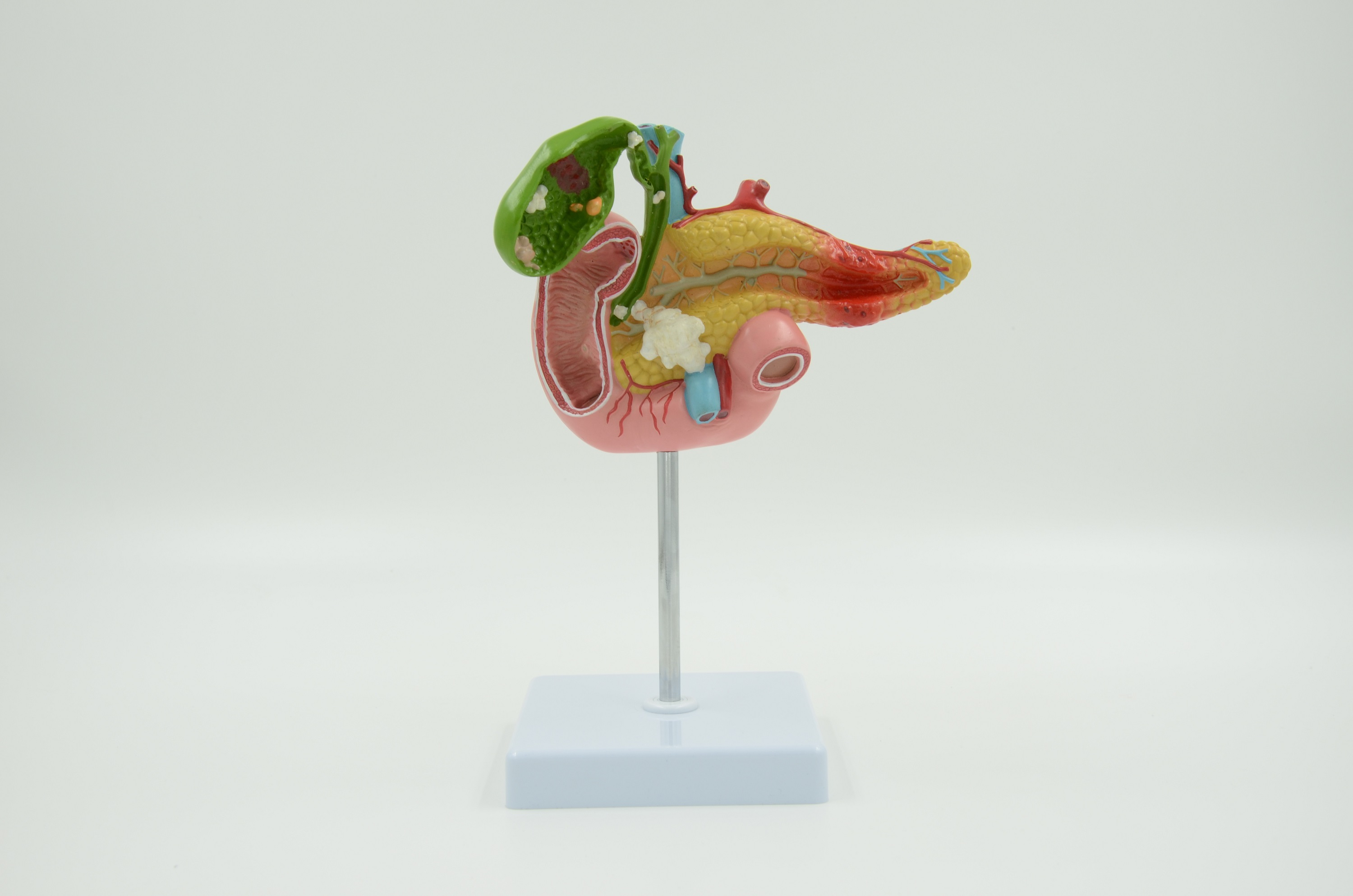 PATHOLOGICAL MODEL OF THE PANCREAS ,DUODENUM AND GALLBLADDER - Eduscience