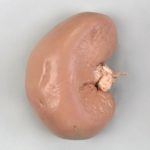Sheep Kidney Preserved Specimen