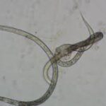 Vinegar Eel Anguilla Aceti