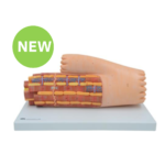 Enlarged Human Cardiac Muscle