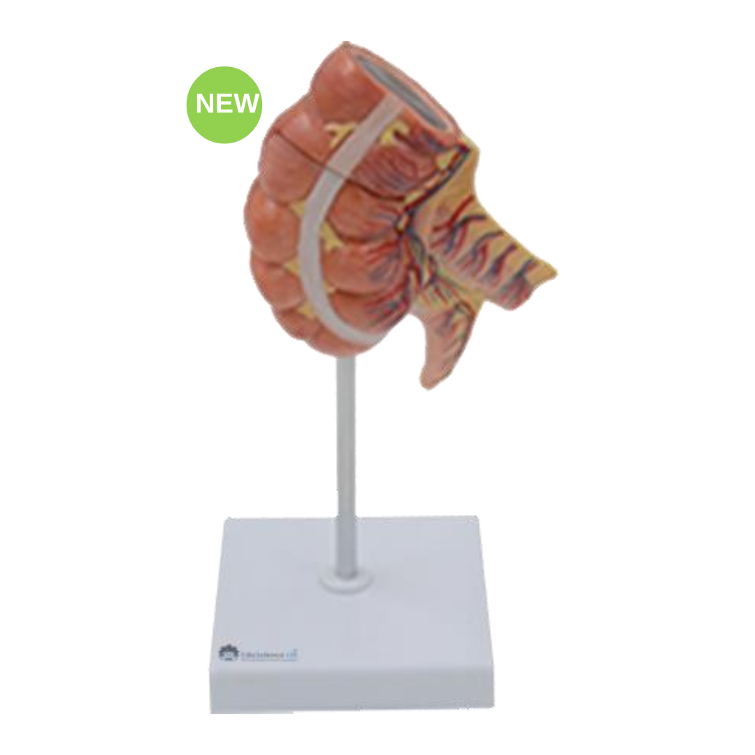 Appendix And Caecum Model