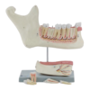 Enlarged Lower Jaw Model