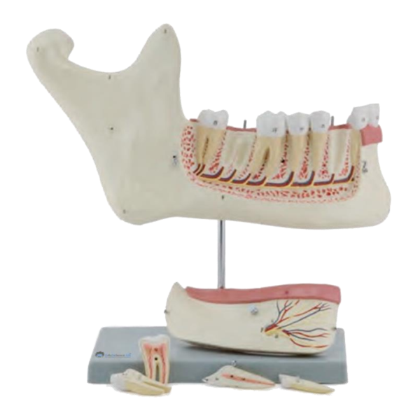 Enlarged Lower Jaw Model