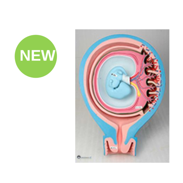 Fetal Membrane - Uterus Model