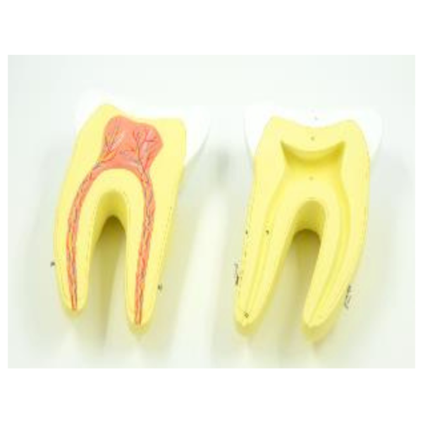 Enlarged Human Molar 2Parts
